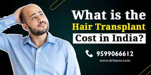 What is the Hair Transplant Cost in India? – Dr. Navnit Haror