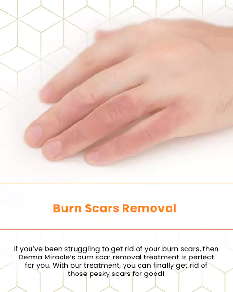 burn scars
