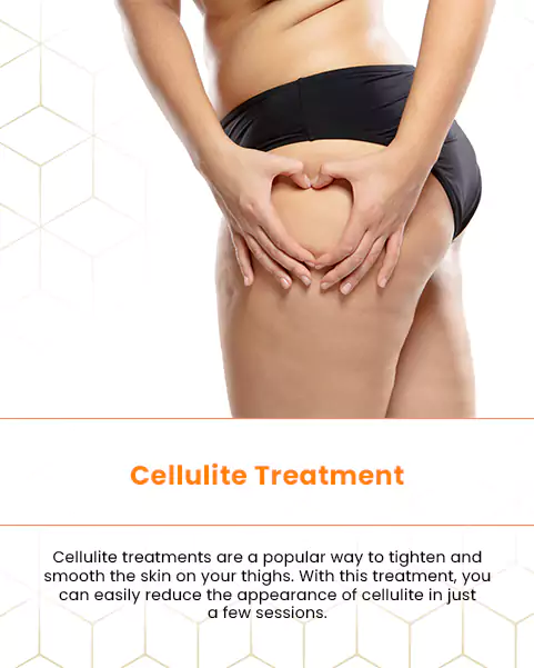 cellulite treatment
