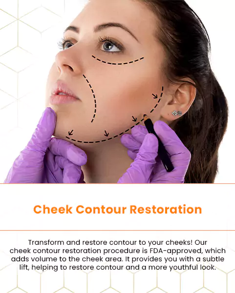 cheek contour restoration