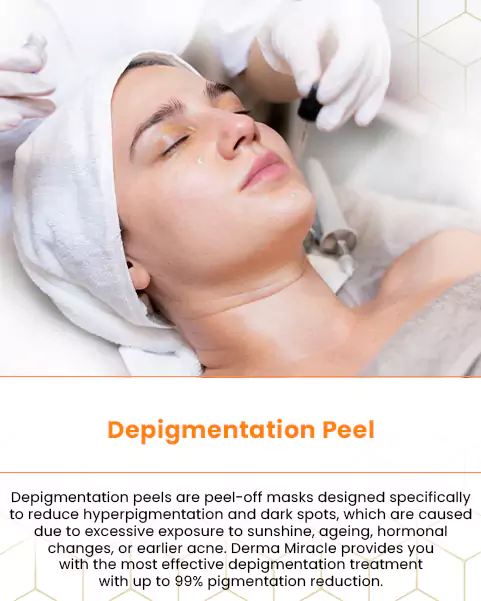 depigmentation peel
