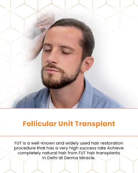 Fut Hair transplant Doctor in Delhi | Check Cost, Clinic and Sucess Rate