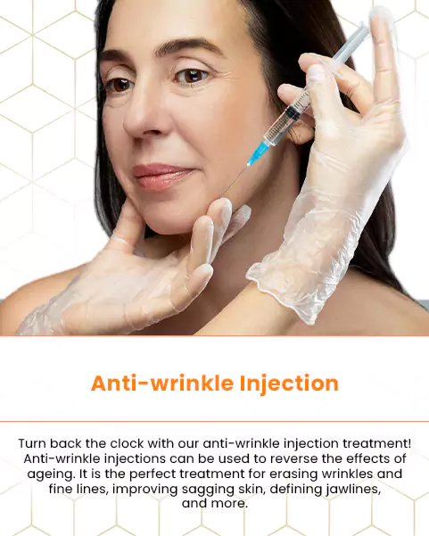 anti wrinkle injection