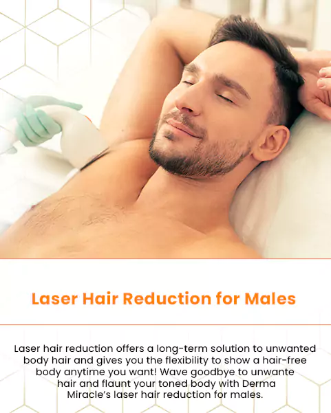 laser hair reduction for males
