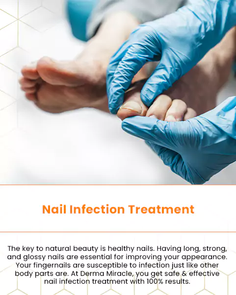Nail Fungus Repair Treatment, Maximum Strength Fingernail and Toenail  Fungus Treatment with Natural Ingredients Formula - Walmart.com