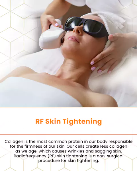 rf skin tightening