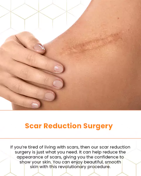 body scar reduction