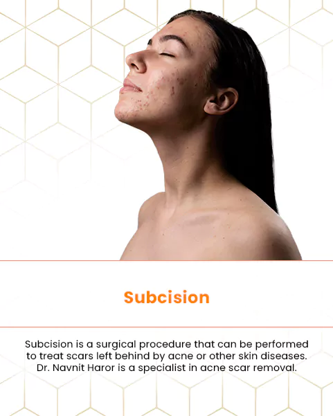subcision