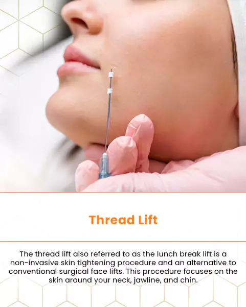 thread lift