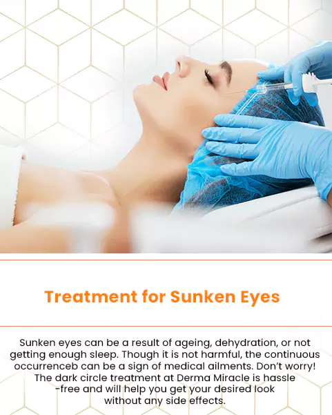 treatment for sunken eyes