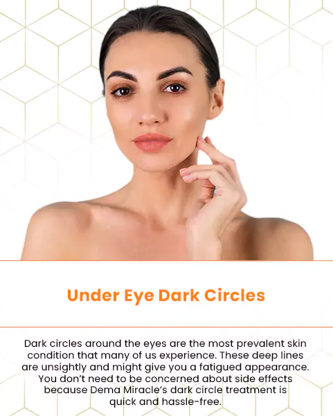 under eye dark circles