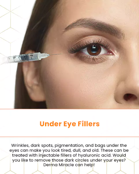 under eye fillers